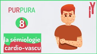 EPISODE7 sémiologie cardiovasculaire purpura [upl. by Anrev]