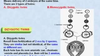 44 General Embryology Twins amp Dizygotic Twins [upl. by Moreen]