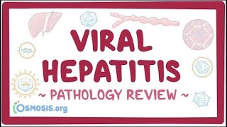 Viral hepatitis Pathology Review [upl. by Nyleak]