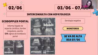 Cirrosis descompensada por ascitis [upl. by Ayanej]