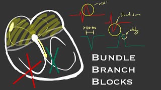 Bundle Branch Block the Series Part 1 Basics of conduction and complete blocks I The Pacemaker [upl. by Anyrb]