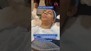 How do dermatologists or cosmetologist treat acne  Dr Vasundhara shorts [upl. by Bonina]