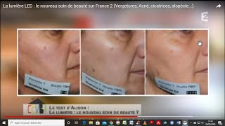 La lumière LED  le nouveau soin de beauté sur France 2 Vergetures Acné cicatrices alopécie [upl. by Mcdade]