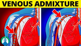 Venous Admixture Medical Definition  Quick Explainer Video [upl. by Prisca]