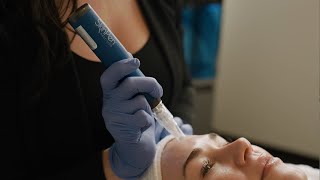 SkinPen® Microneedling amp Exosomes  Elevate Your Microneedling Treatment for Total Skin Rejuvenation [upl. by Nyrat]