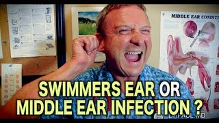 Is it Swimmers Ear or Middle Ear Infection  Pediatric Advice [upl. by Pacifica]