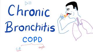 Chronic Bronchitis  COPD  Pulmonology Lectures [upl. by Mohammad]