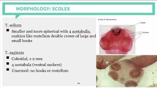 Parasitology Cestodes Part 2 [upl. by Adekahs801]