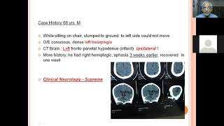 Clinical localisation of StrokeDr HV srinivas [upl. by Illib]