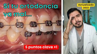 ¿Tu ortodoncia va mal 🔥 5 Puntos clave  Ortodoncia mal hecha  Dr Yamir Rivera [upl. by Eldwun728]