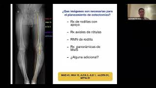 WEBINAR Osteotomías periarticulares en RODILLA [upl. by Drucilla568]