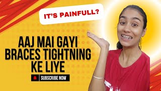 Braces Tightening Ke Liye Gayi Aaj🤐  More Update Of My Daily Routine  Varsha Daily Vlogs [upl. by Rep]