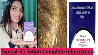 Topisal3 Lotion reviewuses and sideeffects complete information StyleWithRuchi [upl. by Notkcorb807]