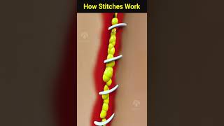 How wound stitches really work shorts facts  Creativelearning3d [upl. by Callida]