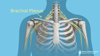 What Is Brachial Plexus Injury  Boston Children’s Hospital [upl. by Aitahs]