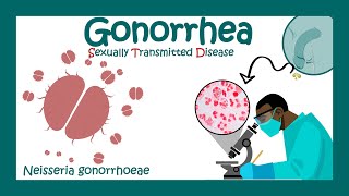 Gonorrhea Signs amp Symptoms  Neisseria gonorrhoeae  Diagnosis and Treatment of Gonorrhea  USMLE [upl. by Einahets]