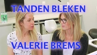 Tanden bleken met Valerie Brems  FURROWNL [upl. by Naarah14]