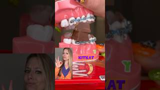 CANDY YOU CANT EAT WITH BRACES HALLOWEEN EDITION ORTHODONTIST REACTS LOLLIPOPS CRUNCHY FOOD ASMR [upl. by Cristiano]