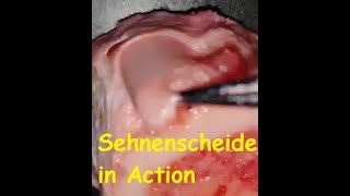 Die Sehnenscheide  Vagina synovialis tendinis in der Bewegung Anatomie in Action  LIVE [upl. by Nonnahsed388]