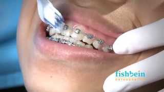 Orthodontic Home Care Instructions  Braces  Brushing [upl. by Gladwin]