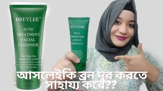 breylee acne treatment facewash review ব্রন দুর করতে এই ফেসওয়াশ টি কতটা সহায়ক [upl. by Eimmot]