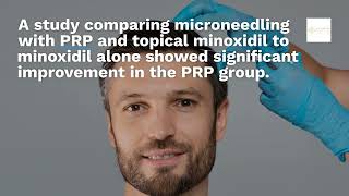 Reveal Thicker Hair Microneedling with PRP in Memorial Houston TX [upl. by Asnarepse]