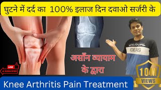 घुटने के दर्द का इलाज बिना ऑपरेशन  Knee Arthritis Pain Treatment [upl. by Erdreid]