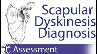 Diagnosing Scapula Dyskinesia [upl. by Paik]