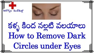 కళ్ళ కింద నల్లటి వలయాలు  How to Remove Dark Circles under eyes in Telugu [upl. by Constanta]