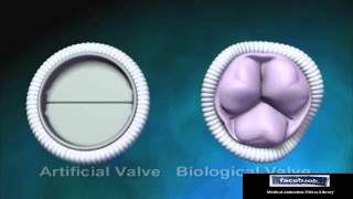 Biological Aortic Heart Valve  Animation Video [upl. by Aneda990]