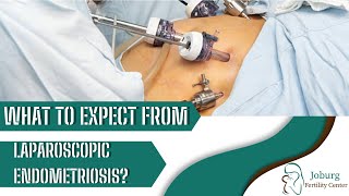 WHAT TO EXPECT FROM LAPAROSCOPY FOR ENDOMETRIOSIS [upl. by Doownil750]