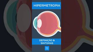 Hipermetropia Definição e sintomas  Kenhub hipermetropia [upl. by Nyer122]