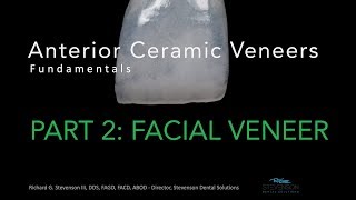 Anterior Ceramic Veneers Part 2 Facial Veneer [upl. by Frendel]