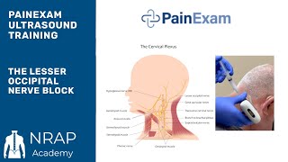 The Ultrasound Guided Lesser Occipital Nerve Block NRAP Academys Ultrasound Course excerpt [upl. by Ennovoj21]