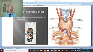 Thyroid disorders in Arabic 7  Retrosternal Goiter   by Dr Wahdan [upl. by Ocsirf]