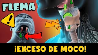 ¡CUIDADO EXCESO DE MOCO EN LA GARGANTA  CAUSAS Y TRATAMIENTO [upl. by Eldwon]