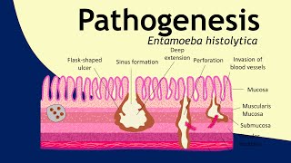 Pathogenesis of Entamoeba histolytica  parasitology  Basic Science Series [upl. by Farnsworth]