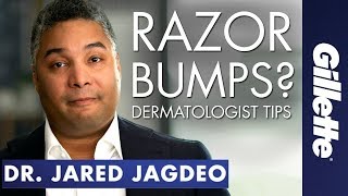 Have Razor Bumps amp Ingrown Hairs  Gillette SkinGuard Dermatologist Tips [upl. by Aretha]