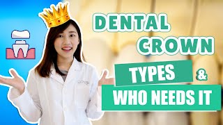 Dental Crowns What Type of Crown Should You Get [upl. by Yerac]