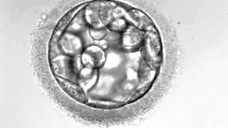 Development of hatching Embryo blastocyst stage [upl. by Willow]