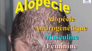 Chute de Cheveux  Alopécie androgenique chez lHomme et chez la Femme [upl. by Fachanan]