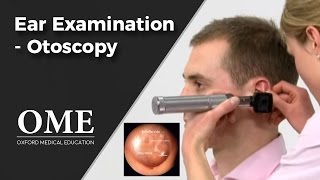 Otoscopy Ear Examination  ENT [upl. by Franny]