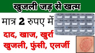 cetirizine tablet  cetirizine tablet uses in hindi  खुजली की गोली [upl. by Yttap]