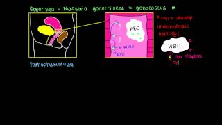 Pathophysiology Diagnosis Treatment and Prevention of Gonorrhea [upl. by Negroj]