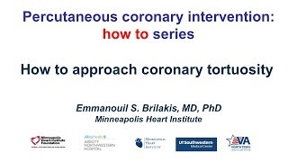 How to approach coronary tortuosity [upl. by Annis]