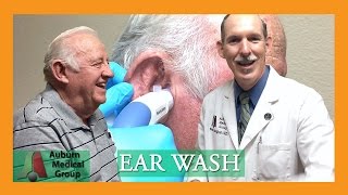 Close up Ear Washing AUTOMATED  Auburn Medical Group [upl. by Tohcnarf]