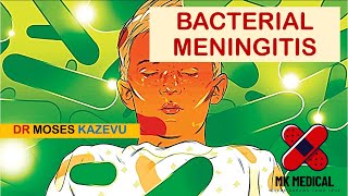 Bacterial Meningitis [upl. by Daphna462]