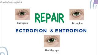 REPAIR ECTROPION amp ENTROPION CPT TOPICS MEDICAL CODING AND BILLING medicalcodercertified [upl. by Zischke]