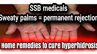 How to cure sweaty palms  Hyperhidrosis  SSB medicals [upl. by Marder]