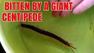 Giant Posionous Centipede Bite Thailand [upl. by Enrak888]